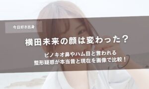 横田未来の顔は変わった？ピノキオ鼻やハム目と言われる整形疑惑が本当昔と現在を画像で比較！アイキャッチ
